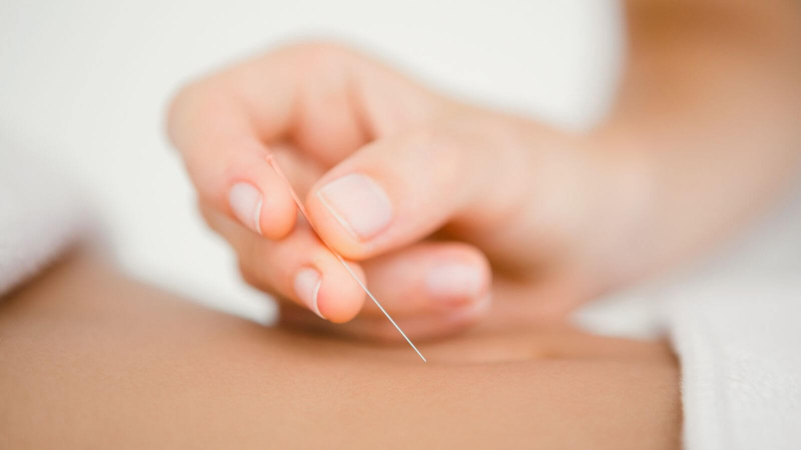 Acupuncture For Fertility (1) #keepProtocol